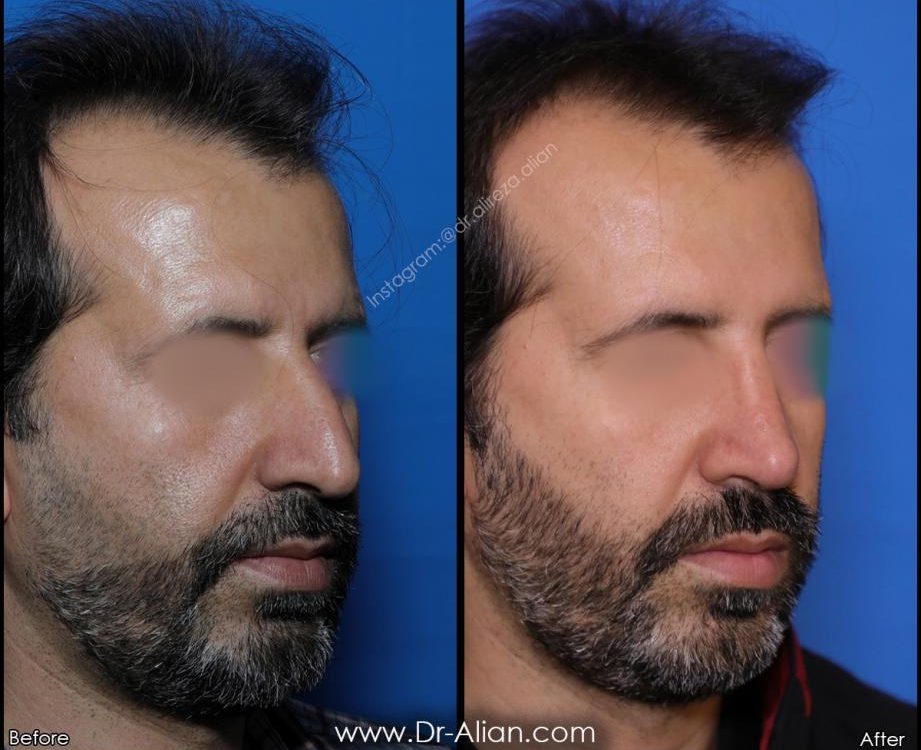 ویژگی های گوشتی