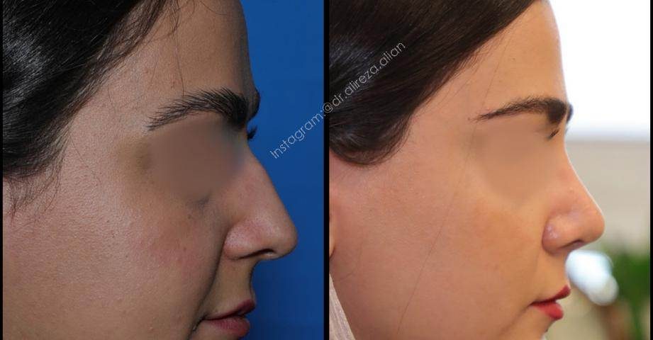 چرا دکتر عالیان؟
